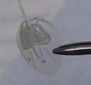 Ahmed_Glaucoma_Valve